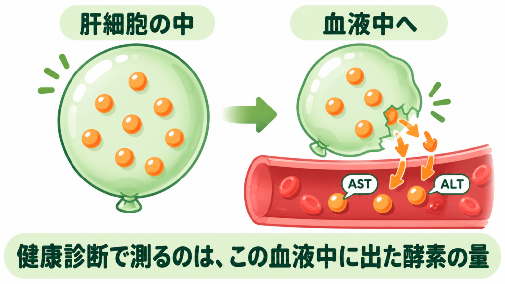 左：無事な風船（肝細胞）の中に酵素の粒。右：穴のあいた風船から酵素の粒が血管へ漏れ出す。健康診断で測るのはこの漏れ出た量